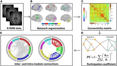 Decreased modular segregation of the frontal–parietal network in major depressive disorder